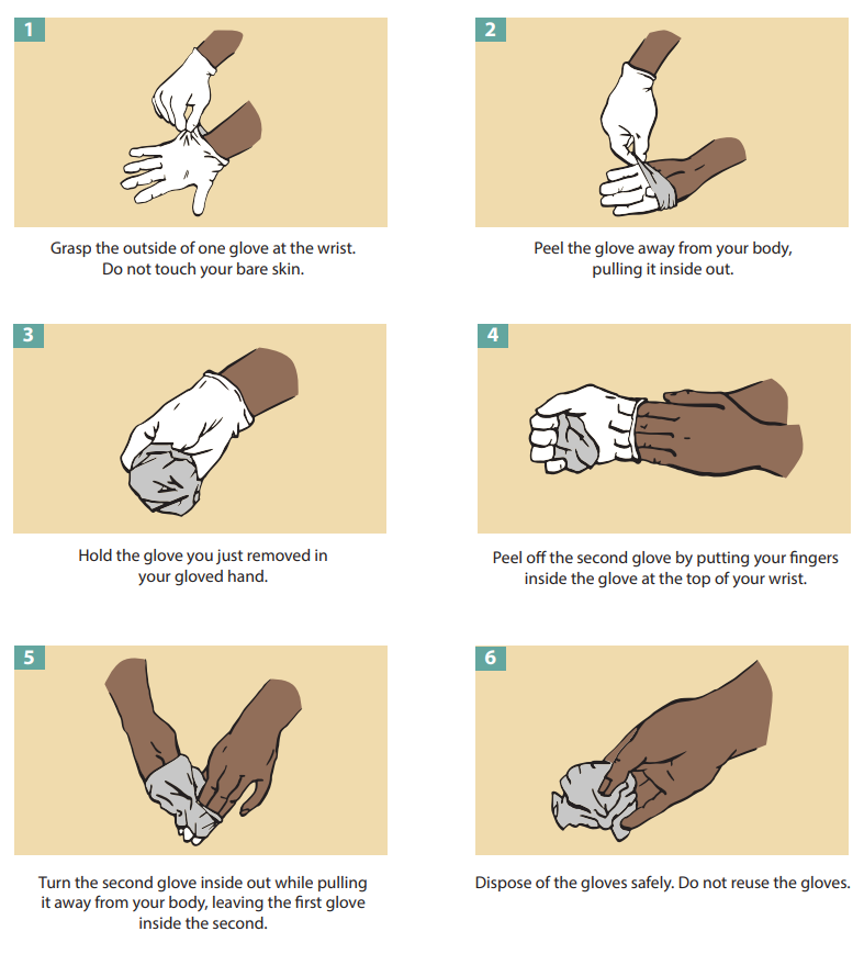 How to remove gloves